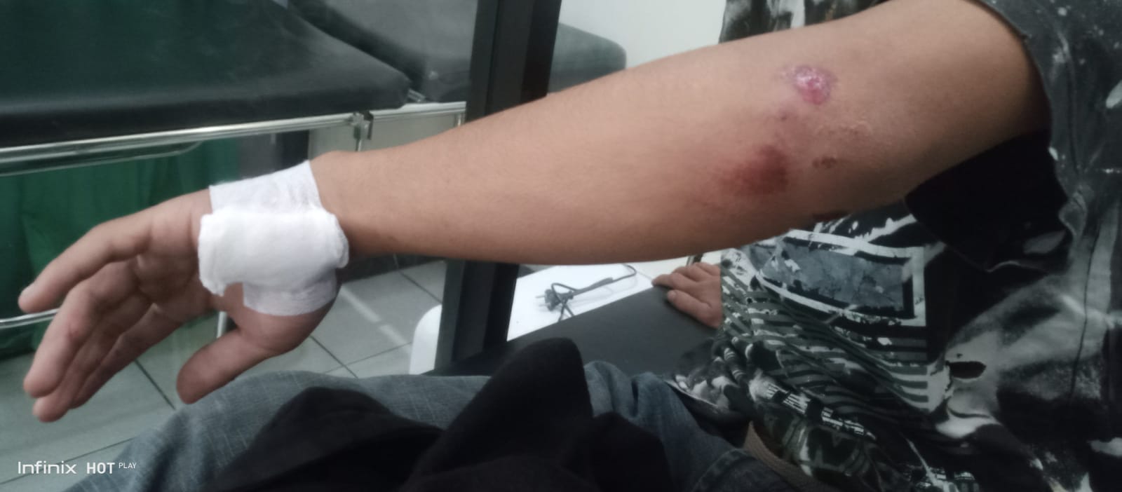 Alami Tindakan Premanisme Pemuda Asal Jongke Lapor Ke Polres Karanganyar